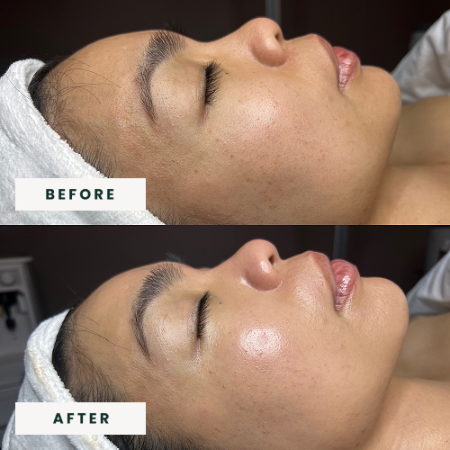 Signature Facial BA 1