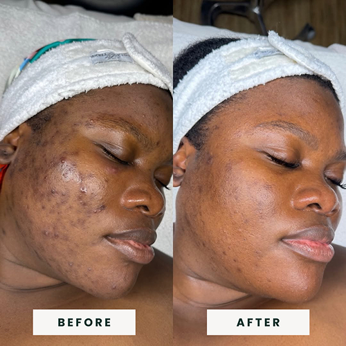 Signature Facial BA 2