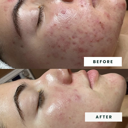 Signature Facial BA 3